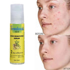 Temulawak - New Acne Removing Serum (Original) 5