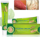 Eczema Cream Herbal Antibacterial Ointment 20g 1