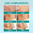 South Moon Scar Spray 2