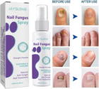 Extra Strong Nail Fungus Treatment Spray - 100ml 1