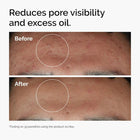 The Ordinary Niacinamide 10% + Zinc 1% Serum 30ml | سيروم النياسيناميد والزنك 4