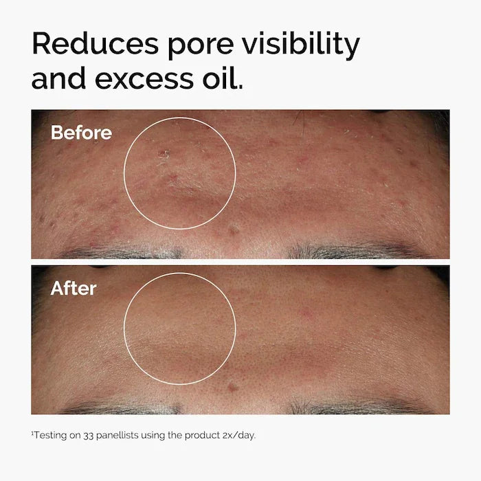 The Ordinary Niacinamide 10% + Zinc 1% Serum 30ml | سيروم النياسيناميد والزنك