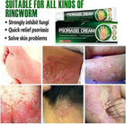 Psoriasis Cream - Herbal Plant Extracts 2