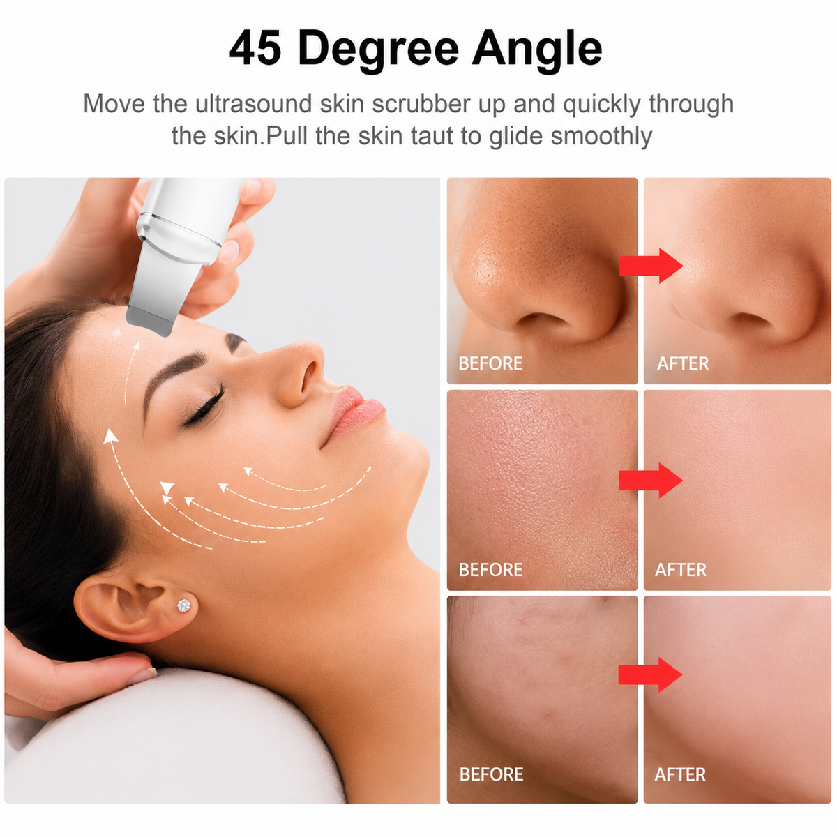 Ultrasonic Face Blackhead Remover Spatula - Majlismart