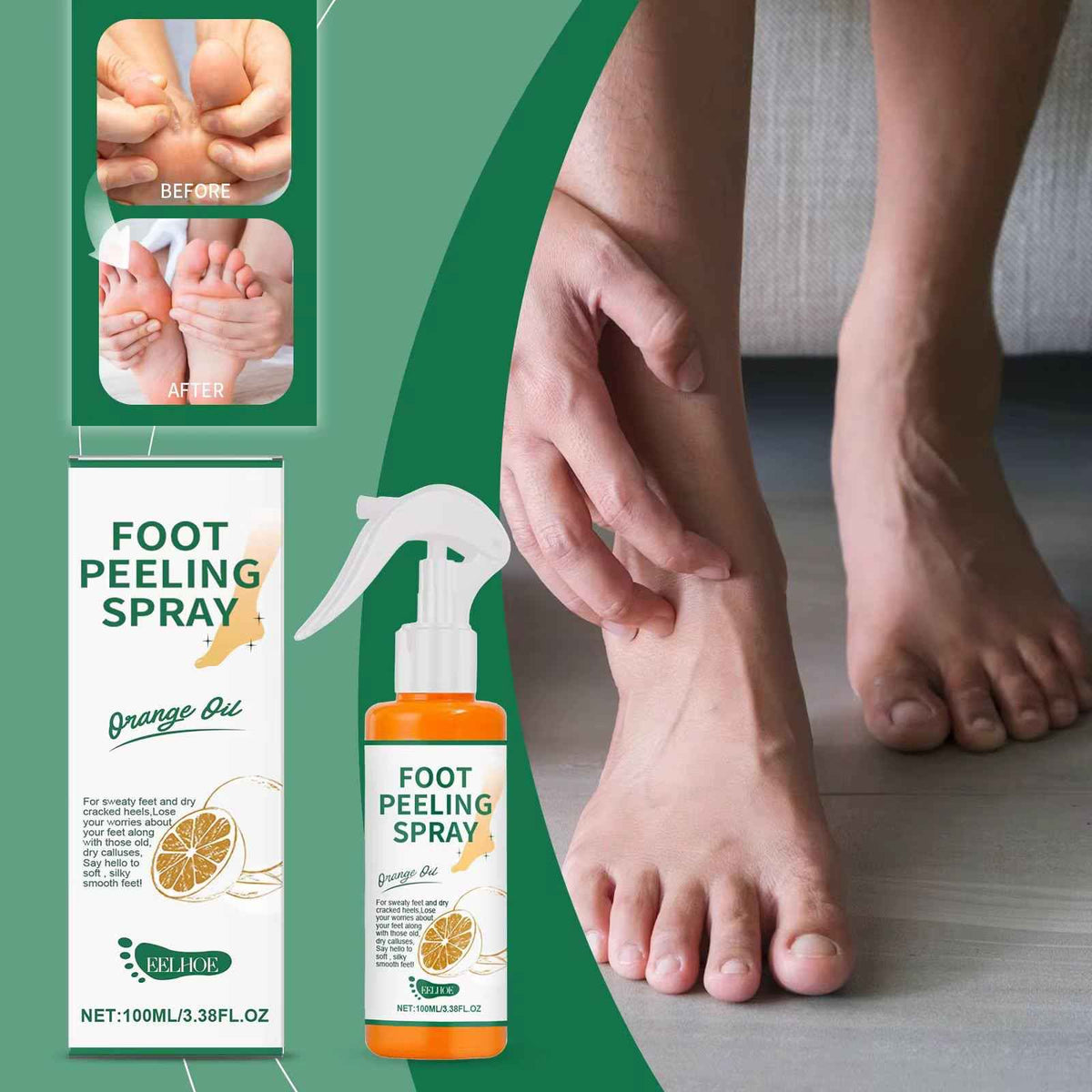 Foot Peeling Spray with Orange Oil | Deep Cleansing & Moisturising Heel Repair | بخاخ تقشير القدمين بزيت البرتقال