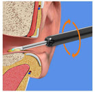 Earwax Removal Kit 3