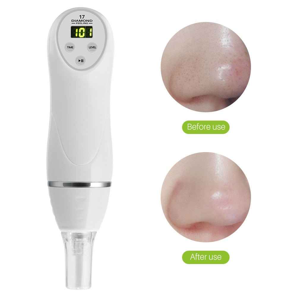 Electric Pore Suction &amp; Acne Removing Beauty Cleaner