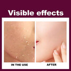 Exfoliating Gel Cream 2