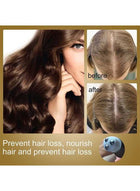 eelhoe Organic Hair Serum Roller – Scalp Nourishment & Hair Growth 3