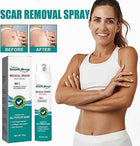 Medical Scar Removal Spray 1
