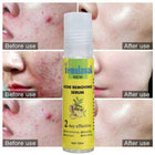 Temulawak - New Acne Removing Serum (Original) 1