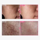 Tosowoong Arbutin Brightening Cream 4